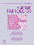MSI-High RAS-BRAF wild-type colorectal adenocarcinomas with MLH1 loss have a high frequency of targetable oncogenic gene fusions whose diagnoses are feasible using methods easy-to-implement in pathology laboratories